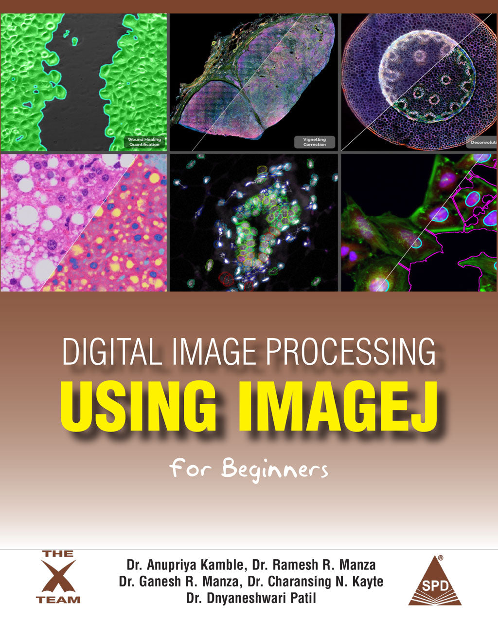 Digital Image Processing Using IMAGEJ For Beginners (Paperback)